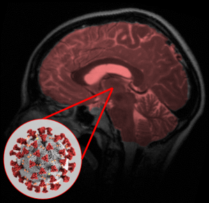 NEUROCOG-COVID